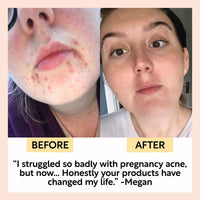 Upcircle Face Moisturiser Vitamin E Aloe | Will's Vegan Store