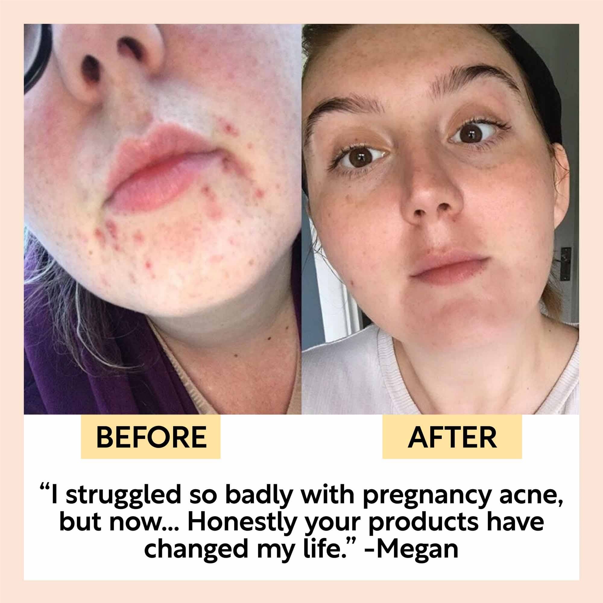 Upcircle Face Moisturiser Vitamin E Aloe | Will's Vegan Store